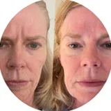 Stephanie's before and after